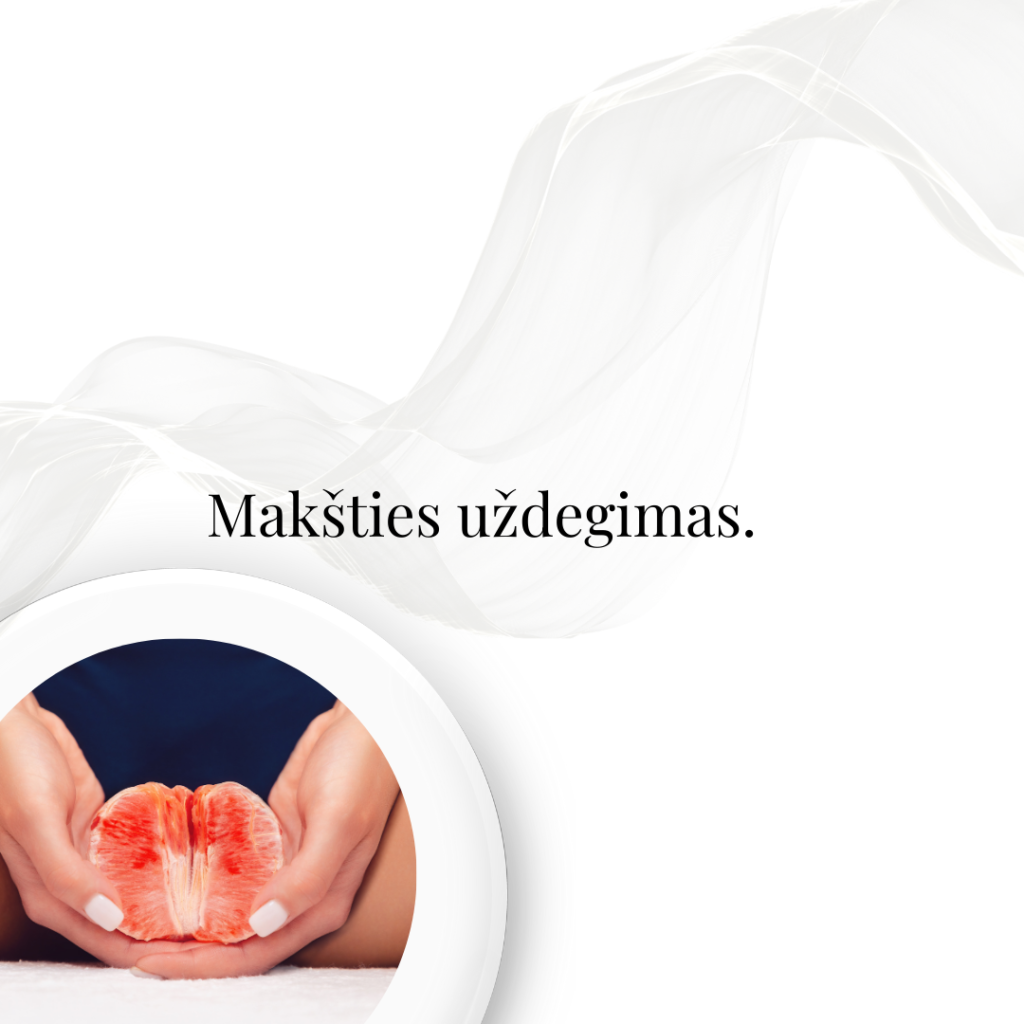 Makšties uždegimas