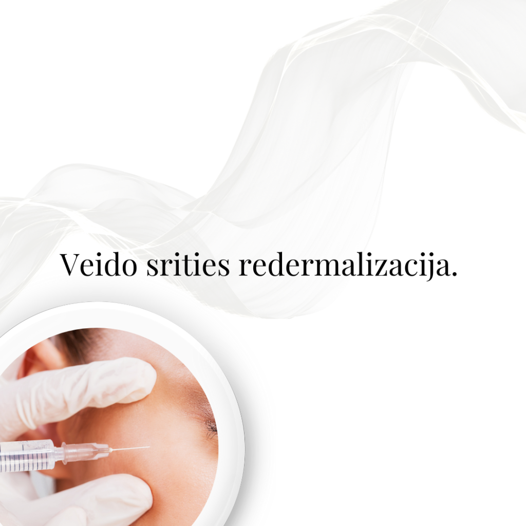 Veido srities redermalizacija