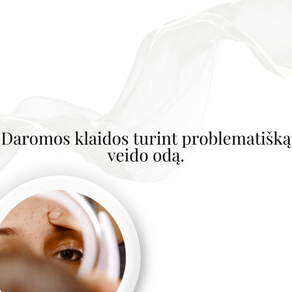 Daromos klaidos turint problematišką veido odą