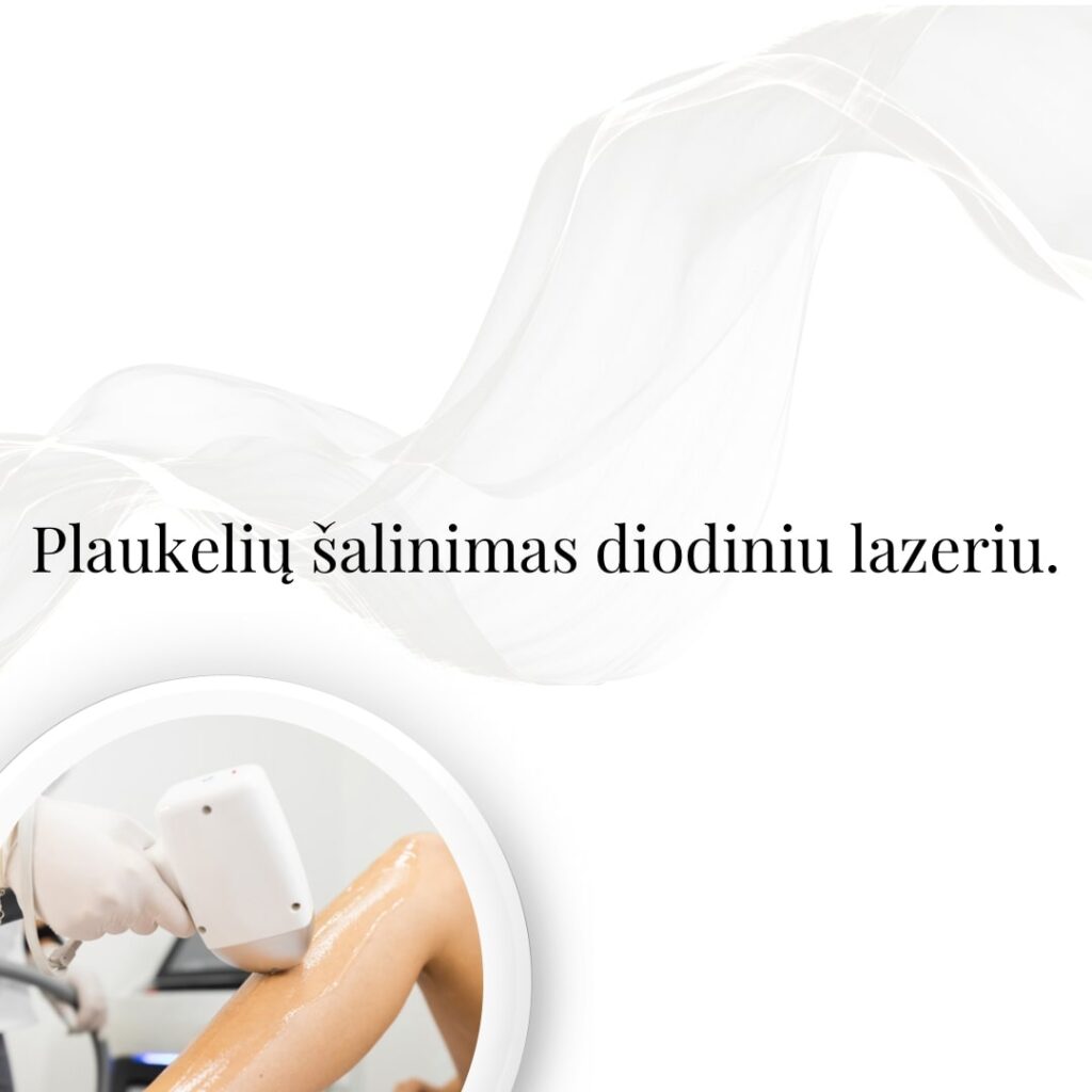 Plaukelių šalinimas diodiniu lazeriu